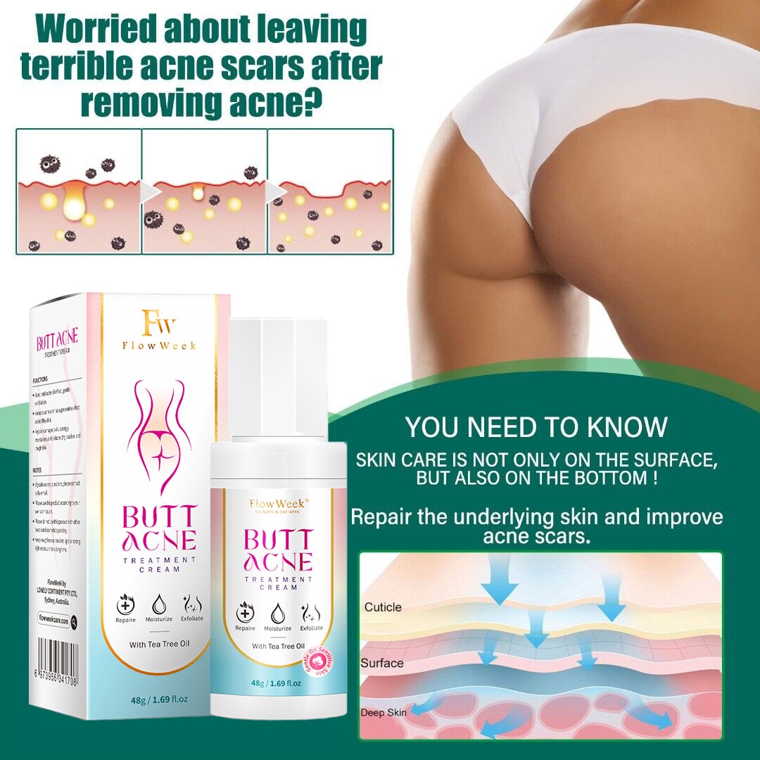 Butt Acne Clearing Spot Treatment Cream - wonderfulandamazingstuff